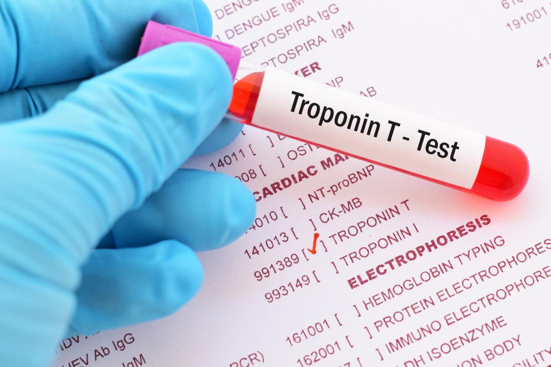 Geslachtsverschil voor behandeling blijft bestaan, zelfs met betere troponinetest